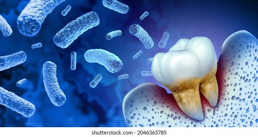 11,146 Teeth infection Images, Stock Photos & Vectors | Shutterstock