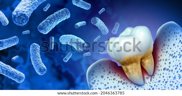 Tooth bacterial infection and teeth decay\
disease as an unhealthy molar with periodontitis as an infectious\
bacteria concept with inflammation as a 3D illustration on a blue\
background.