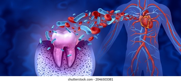 Tooth Decay And Heart Disease As An Unhealthy Molar With Periodontitis Due To Poor Oral Hygiene Health Problem As A Bacteria Infection In The Blood As A 3D Illustration On A Blue Background.