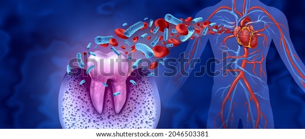 Tooth decay and heart disease as an unhealthy\
molar with periodontitis due to poor oral hygiene health problem as\
a bacteria infection in the blood as a 3D illustration on a blue\
background.