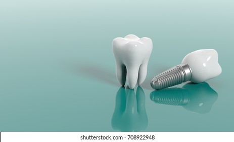 Zahn- und Zahnimplantat einzeln auf grünem Hintergrund. 3D-Illustration