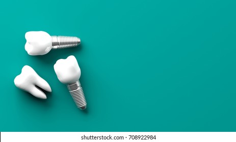 Tooth And Dental Implants Isolated On Green Background. 3d Illustration