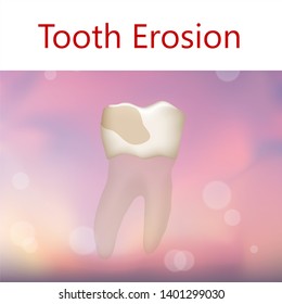 Tooth Erosion. Realistic Anatomy Illustration. Pink Abstract Background.