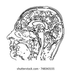 Topographic Map MRI Of The Human Brain.