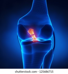 Torn Anterior Cruciate Ligament