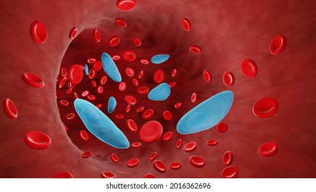 Toxoplasma In Bloodstream, Parasitic Bloodstream Infection 3d Illustration