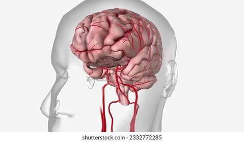A transient ischemic attack is a mini stroke with similar symptoms to an ischemic stroke but without lasting effects 3D rendering