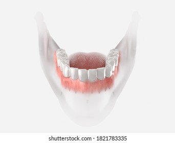 Transparent retainer fixed on lower jow. Realistic 3d illustration