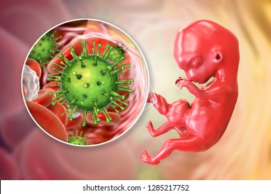 Transplacental Transmission Of Cytomegalovirus CMV To Human Embryo, 3D Illustration