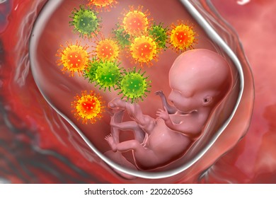 Transplacental Transmission Of Cytomegalovirus (CMV) And Other Viruses To Human Embryo, Conceptual 3D Illustration