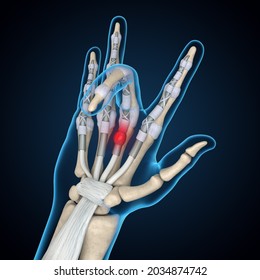 Trigger Finger 3D Rendering, Finger Anatomy, Hand Anatomy