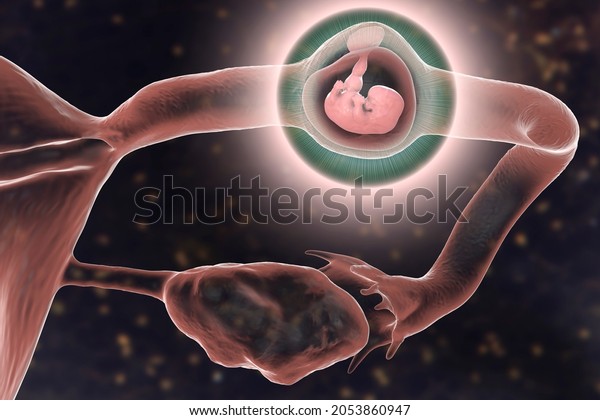 Tubal\
ectopic pregnancy, 3D illustration showing an 7-week human fetus\
implanted in the fallopian tube instead of\
uterus