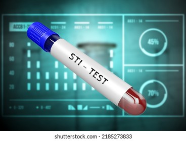 Tube Blood Sample For STI Test. Sexually Transmitted Infection. 3D Illustration