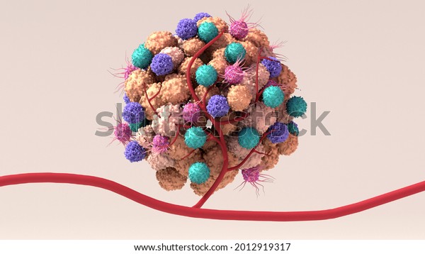 Tumor\
microenvironment, normal cells, molecules, and blood vessels that\
surround and feed a tumor cell. Microenvironment can affect how a\
tumor grows and spreads. 3d\
illustration