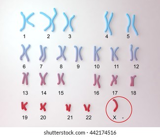 Turners-syndrome karyotype, labeled. X0 karyotype. 3D illustration