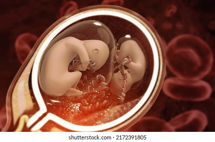 Twin Fetus In The Womb, Overview Of Multiple Pregnancy, 3d Illustration