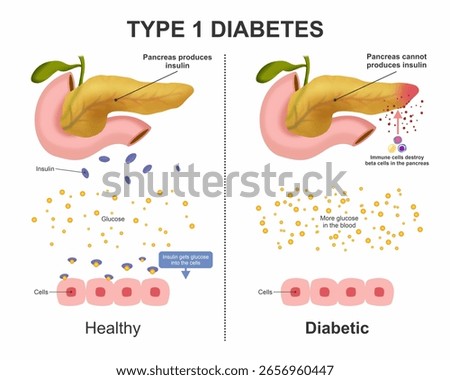 Type 1 Diabetes difference between healthy vs diabetic