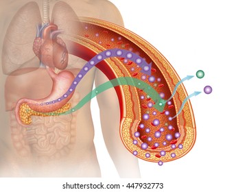 Type 1 diabetes illustration, anatomical image of the human body, highlighting organs such as the stomach and pancreas producing glucose with insufficient amount of insulin.