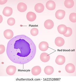 Type Of White Blood Cell Have One Lobe Of Nucleus And Small Granules In Cytoplasm That Called Monocyte With Red Blood Cells And Platelet Background.