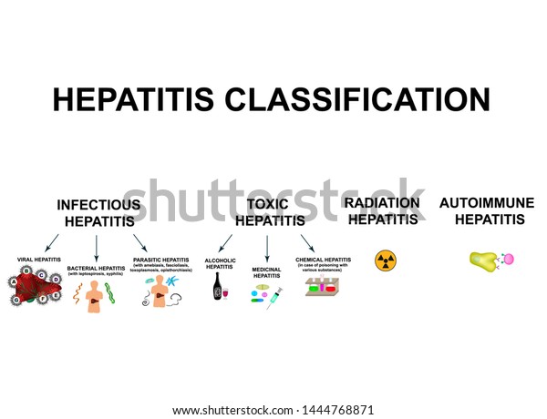 Types Viral Hepatitis Classification Hepatitis B Stock Illustration ...