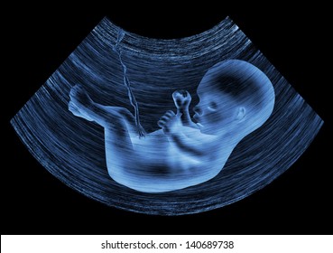 Ultrasound image of baby in mother's womb - Powered by Shutterstock