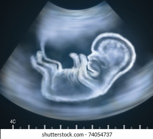 Ultrasound image of baby in mother's womb. Concept.