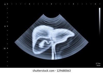 Ultrasound Scan Of Human Liver