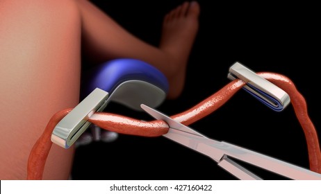 Umbilical Cord 3d Illustration