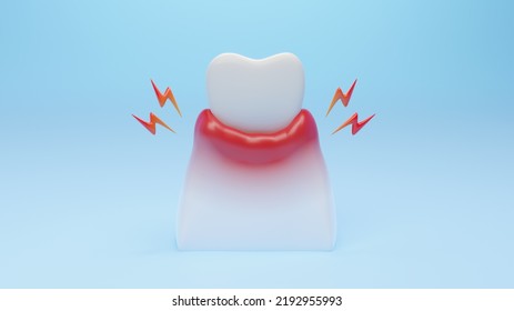 Unhealthy Gum Inflammation Disease By Gingivitis. Dental Gum And Teeth Treatment Concept. 3D Rendering.