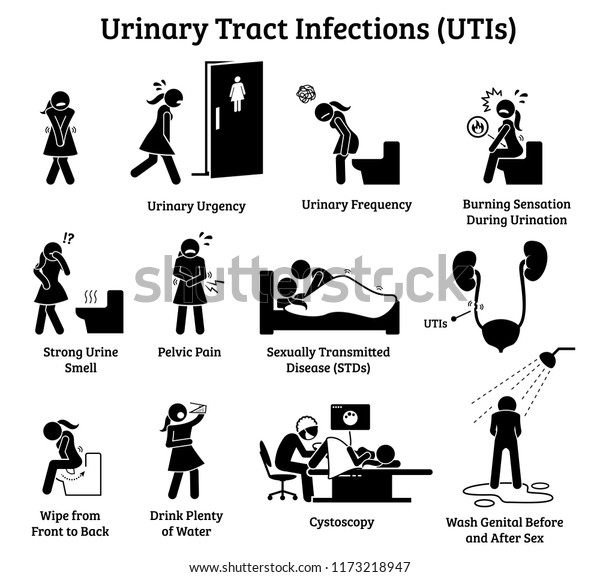 尿路感染症を特徴とするアイコン イラストは 女性の尿路感染の徴候 症状 治療 予防措置を示す のイラスト素材