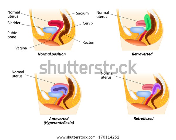 Uterine Position Normal Uterus Rests On Stock Illustration 170114252