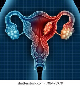 Uterine Cancer Images Stock Photos Vectors Shutterstock