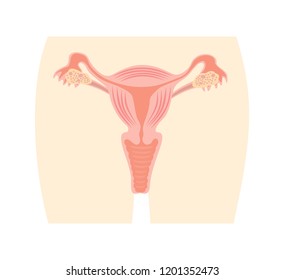 Uterus and ovaries, organs of female reproductive system. bitmap