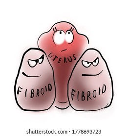 Uterus And Two Evil Fibroids