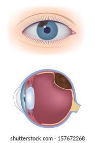 Uveal Melanoma