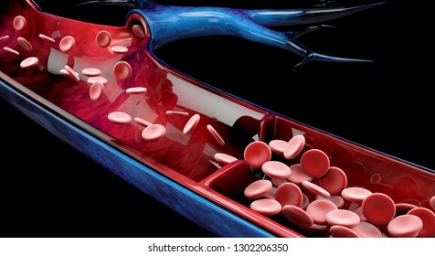 Varicose veins close up. Human legs on a black background, 3d Illustration