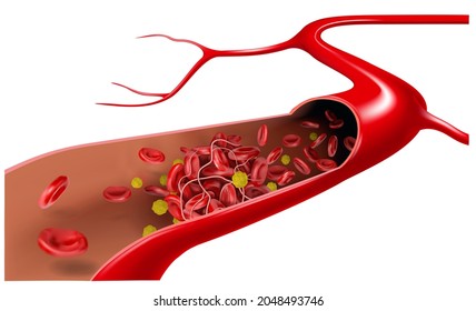 Vein Cholesterol Flows Erythrocytes Form Blood Stock Illustration ...