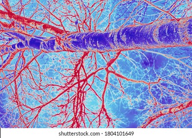 Veins, hemorrhagic stroke. System many small capillaries branch out of the large blood vessels into the circulatory system. Blue and red  fractals background. The concept of human health and disease