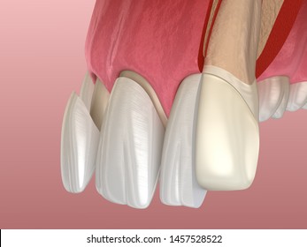 <b>Porcelain</b>: изображения, стоковые фотографии и векторная ...