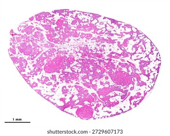 Very low-magnification micrograph of an elderly parathyroid gland showing abundant adipose tissue, reduced parenchyma, and prominent nonfunctional oxyphil cell nodules. Scale bar: 1 mm.