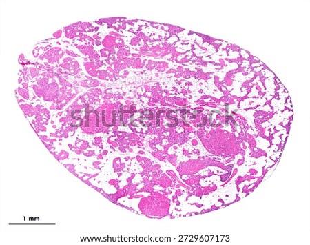 Very low-magnification micrograph of an elderly parathyroid gland showing abundant adipose tissue, reduced parenchyma, and prominent nonfunctional oxyphil cell nodules. Scale bar: 1 mm.