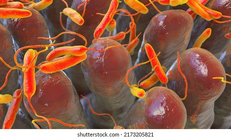 Vibrio Cholerae Bacteria Infecting Small Intestine, 3D Illustration. Bacterium Which Causes Cholera Disease And Is Transmitted By Contaminated Water