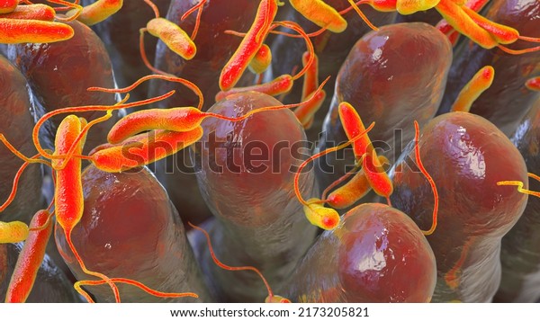 Vibrio cholerae bacteria infecting\
small intestine, 3D illustration. Bacterium which causes cholera\
disease and is transmitted by contaminated\
water