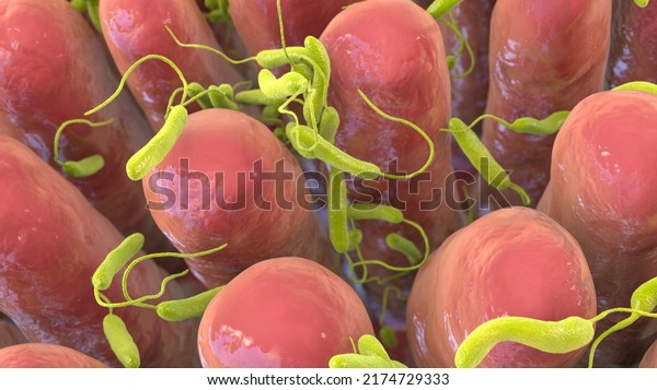 Vibrio cholerae bacteria infecting\
small intestine, 3D illustration. Bacterium which causes cholera\
disease and is transmitted by contaminated\
water