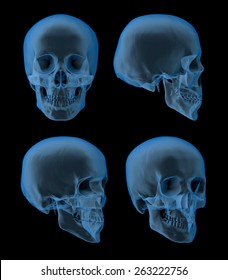 Views of a human skull, x-ray picture, front-, side views