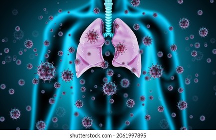 Virus And Bacteria Infected The Human Lungs. Lung Disease. 3d Illustration