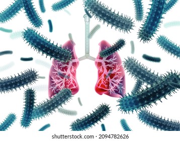 Virus And Bacteria Infected The Human Lungs. Lung Disease. 3d Illustration