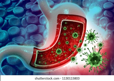 Viral Gastroenteritis Images Stock Photos Vectors Shutterstock