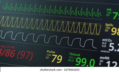 Vital Signs Of The Patient As Heart Rate, Oxygen Saturation And Respiration. ICU Monitor In Hospital. Medical Display. Heartbeat Cardiogram. ECG Or EKG Screen. Depth Of Field Effect. 3D Render Concept