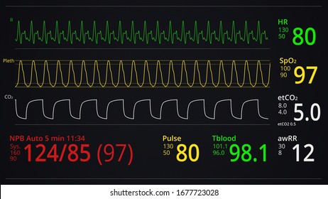 Vital Signs Of The Patient As Heart Rate, Oxygen Saturation And Respiration. ICU Monitor In Hospital. Medical Display. Heartbeat Cardiogram. ECG Or EKG. Concept Illustration. Life Support Equipment 